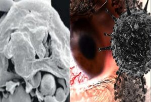 white-fungus-black-fungus_1621632286