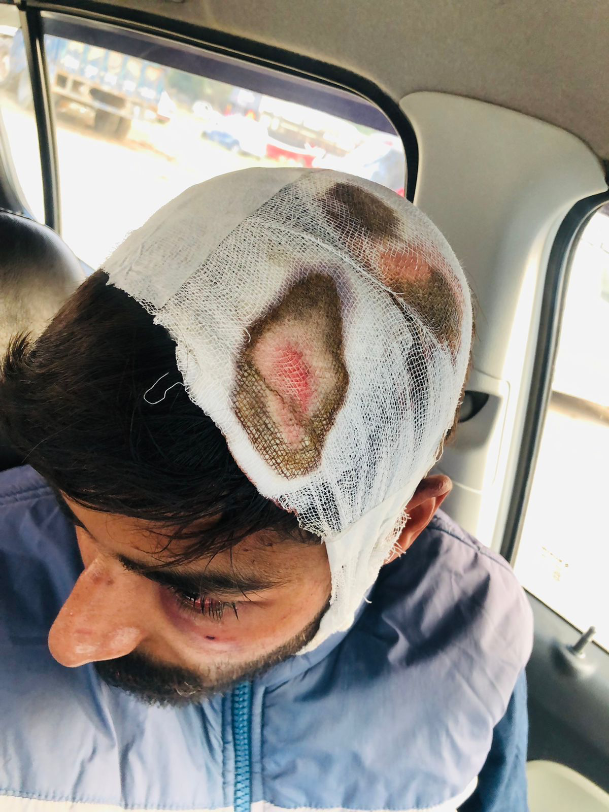 बीटेक छात्र पर अज्ञात बाइक सवार युवकों ने किया धारदार हथियारों से हमला, 2